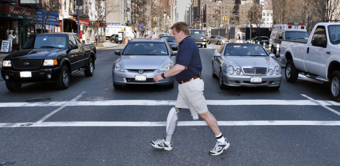 比尔·邓纳姆是第一位使用AI来移动假肢的截肢者