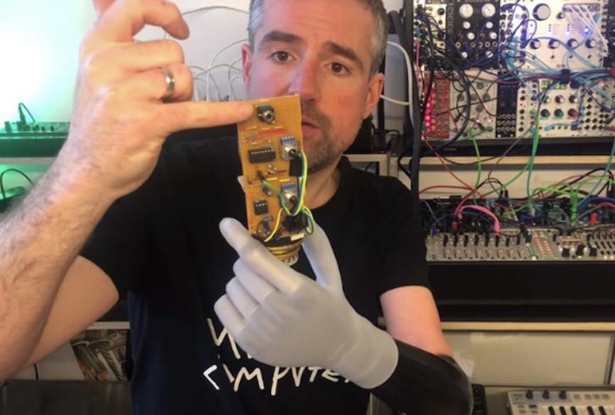 Bertolt使用假肢控制他的模块化合成器以产生电子音乐