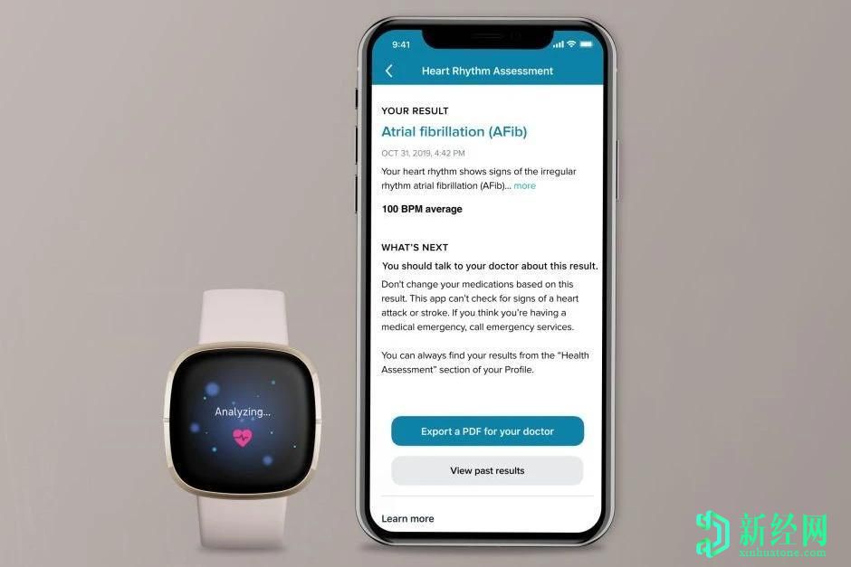 热门的新Fitbit Sense智能手表最好的东西今年可以使用