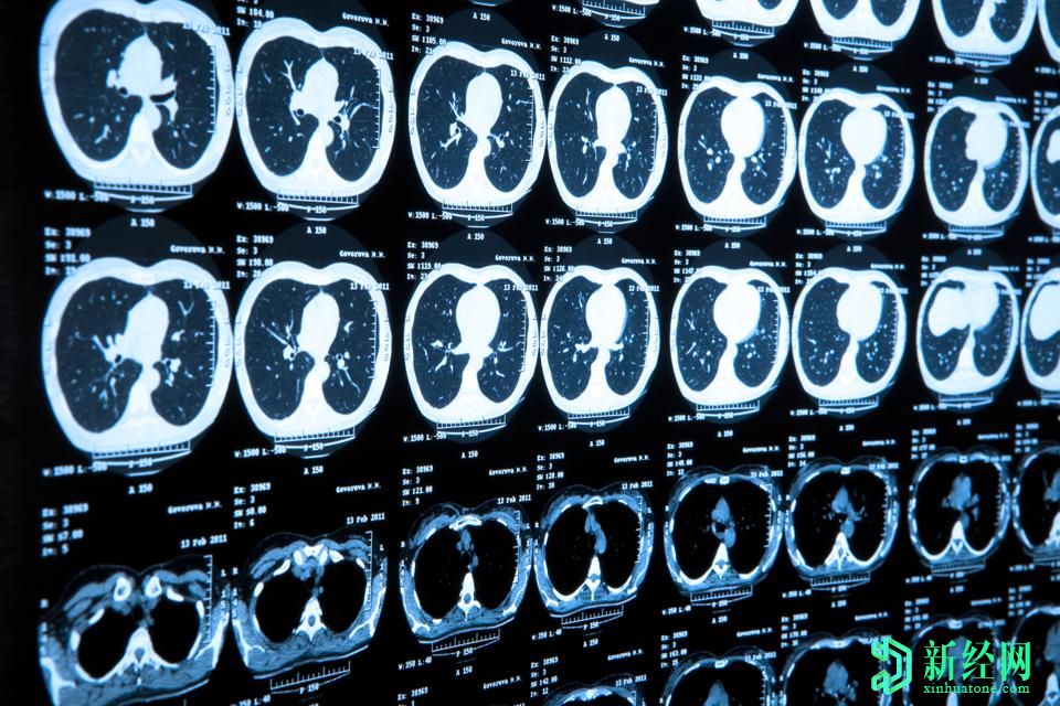 研究人员展示了人工智能如何阻止由医院CT扫描仪引起的网络攻击