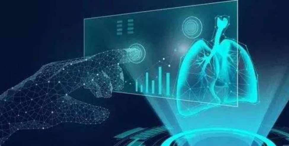Dynatrace添加业务KPI异常检测和分析 以改善用户体验和业务成果