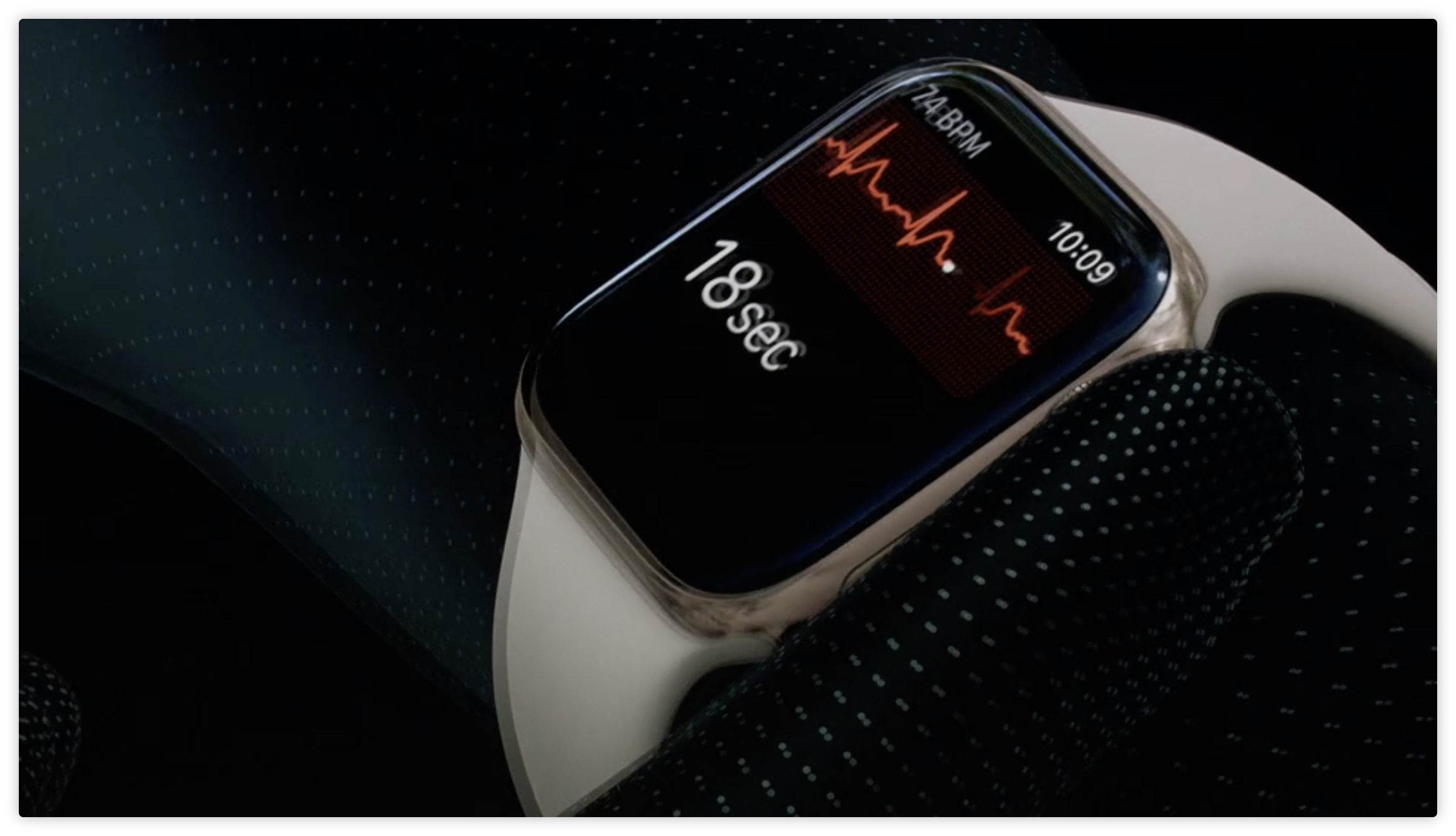 Apple Watch ECG检测到医院ECG遗漏的心脏病证据