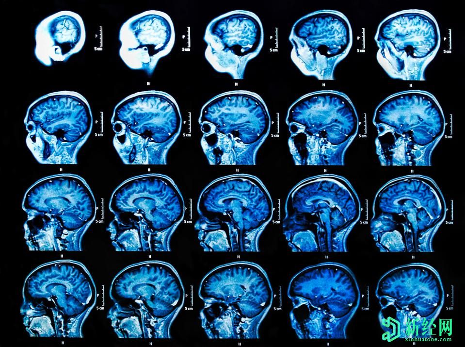 人工智能将改变医疗保健的3种方式