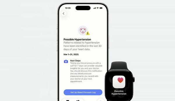 Apple Watch Series 11正式发布 苹果首款5G智能手表！